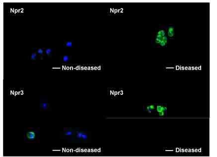 Comparison of Npr2 and Npr3 expression in normal and diseased cartilage from a single donor aged 60 yr.  