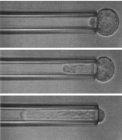 Micropipette aspiration of a neutrophil (adapted from Mientao et al, 1993, Passive mechanical behaviour of human neutrophils. Biophysical J.) 