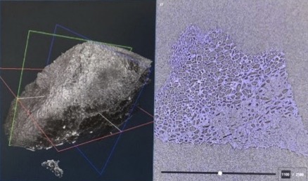 Synchrotron computed tomography of porous material
